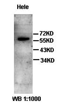 ACSF3 antibody