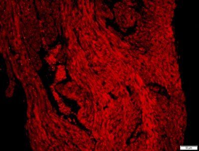ACSL1 Rabbit Polyclonal Antibody