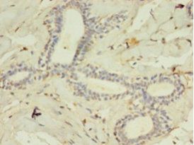 ACSL4 Antibody