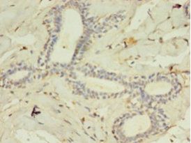 ACSL4 antibody