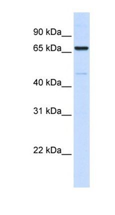 ACSL5 antibody