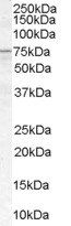 Goat anti-ACSL5 Antibody