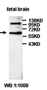 ACSM2A Rabbit Polyclonal Antibody