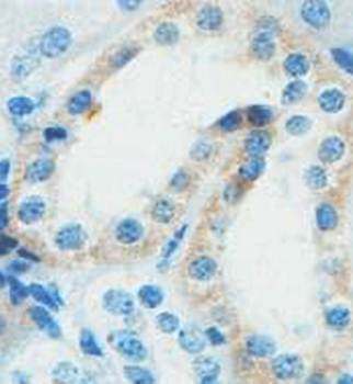 ACSM4 Rabbit Polyclonal Antibody