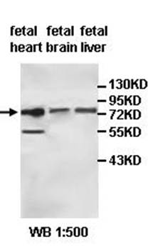 ACSS3 Rabbit Polyclonal Antibody