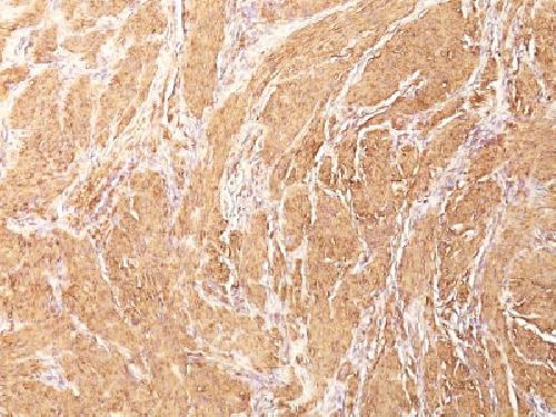 Actin, Muscle Specific (Muscle Cell Marker) Antibody