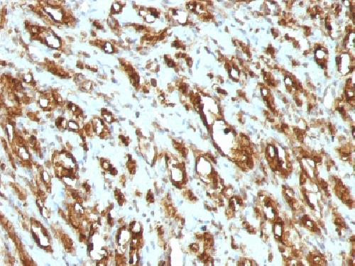 ACTA1 antibody