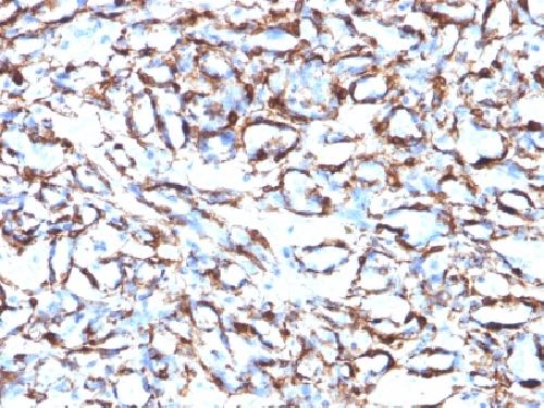 Actin, Smooth Muscle (Leiomyosarcoma Marker) Antibody
