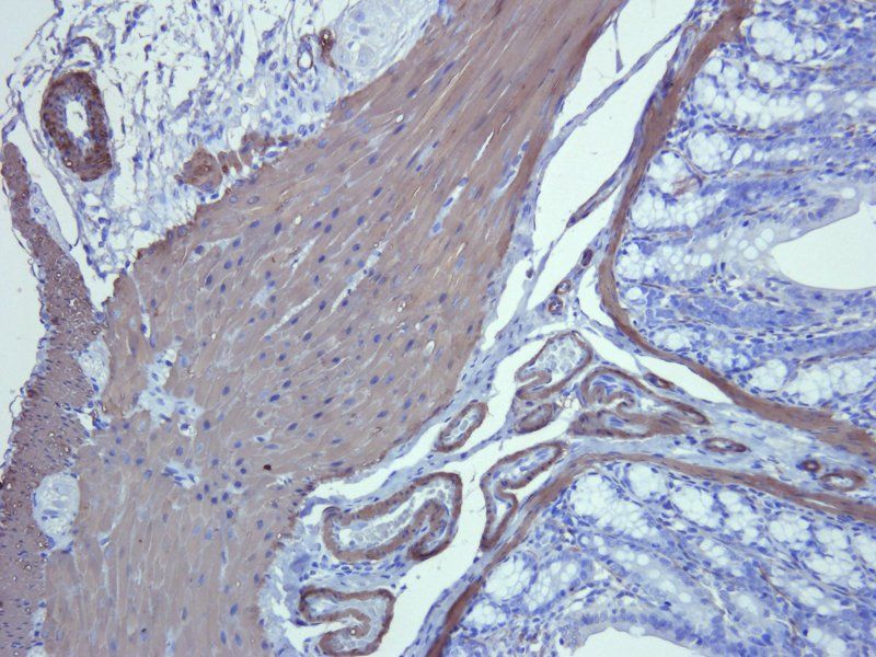 ACTA2 antibody