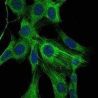 alpha Smooth Muscle Actin Antibody