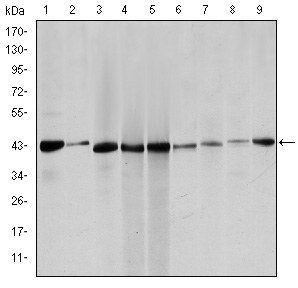 alpha Smooth Muscle Actin Antibody