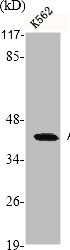 ACTB/POTEKP/ACTG1 Antibody