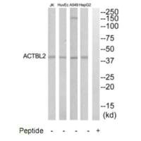 ACTBL2 antibody