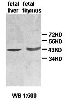 ACTBL2 antibody
