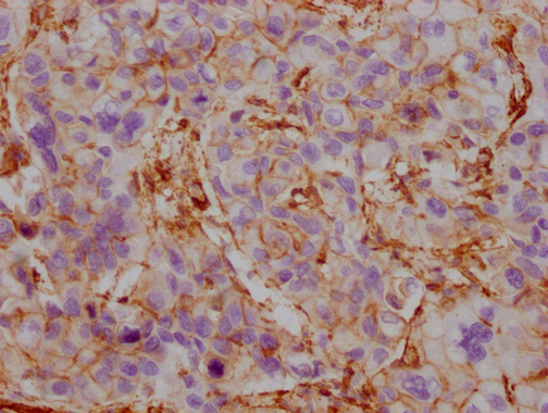 ACTB/POTEKP/ACTG1 Monoclonal Antibody