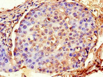 ACTG1 Antibody