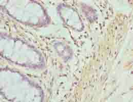ACTG2 Antibody