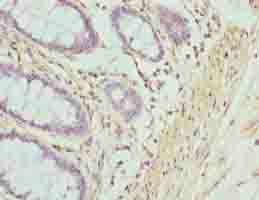 ACTG2 antibody