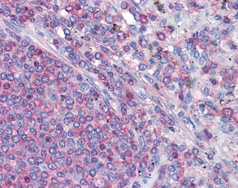 Actin Gamma 1 Rabbit Polyclonal Antibody