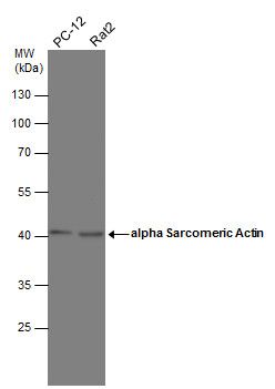 Actin Gamma 1 Rabbit Polyclonal Antibody