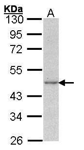 Actin Gamma 1 Rabbit Polyclonal Antibody