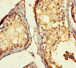 Actin-like protein 7A antibody