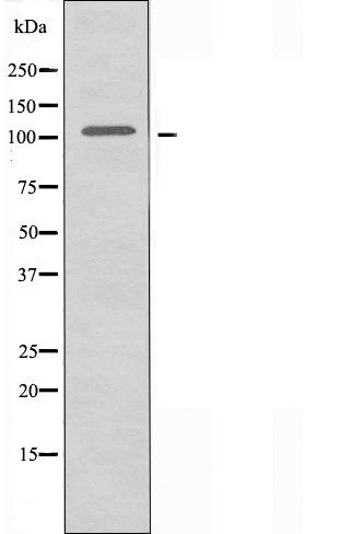 Actinin Alpha-2/3 antibody