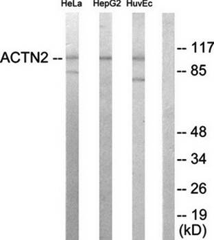 Actinin alpha-2/3 antibody