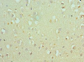 ACTL6B Antibody