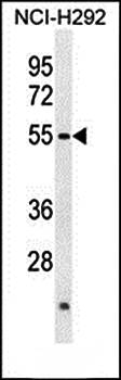 ACTL7A antibody