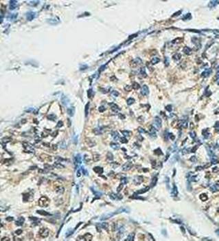 ACTL7A Rabbit Polyclonal Antibody