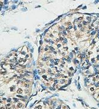 ACTL7A antibody