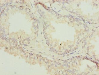 ACTL7B Antibody