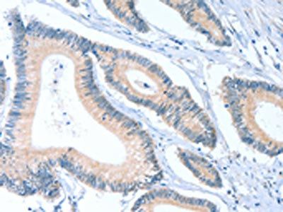 ACTL7B Antibody
