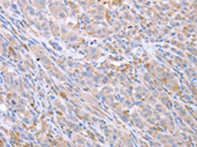 ACTL8 Antibody