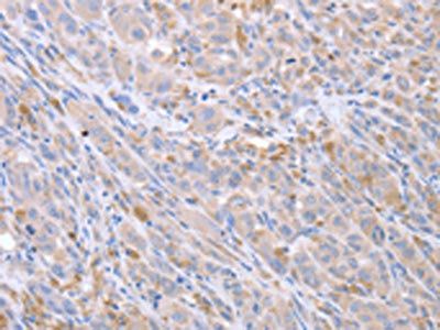 ACTL8 antibody