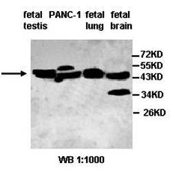 ACTL8 Rabbit Polyclonal Antibody