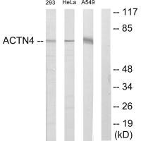 ACTN1/ACTN2/ACTN3/ACTN4 Antibody