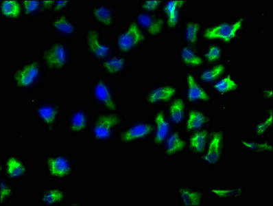 ACTN1 Antibody
