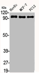 ACTN2/ACTN3 Antibody