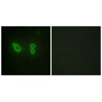 ACTN2/ACTN3 Antibody