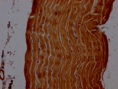 ACTN2 Antibody