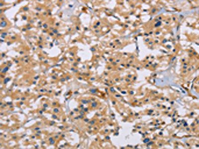 ACTN4 antibody