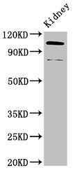 ACTN4 antibody