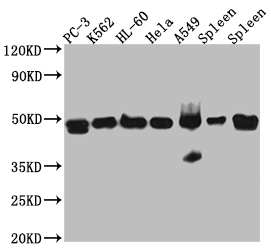 ACTR3 Recombinant Monoclonal Antibody