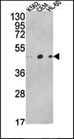 ACTR3B antibody