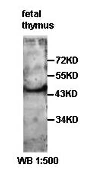 ACTR6 Rabbit Polyclonal Antibody