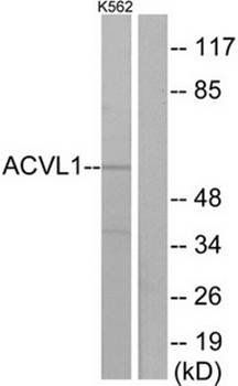 ACVL1 antibody