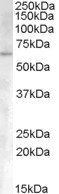 Goat anti-ACVR1 Antibody
