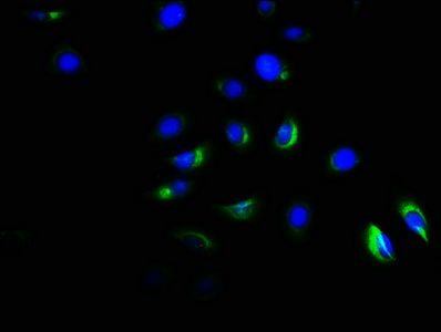 ACVR1B antibody